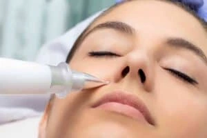 Best Actinic Keratoses Removal 3 Actinic keratoses Ravensthorpe solutions - book in today!