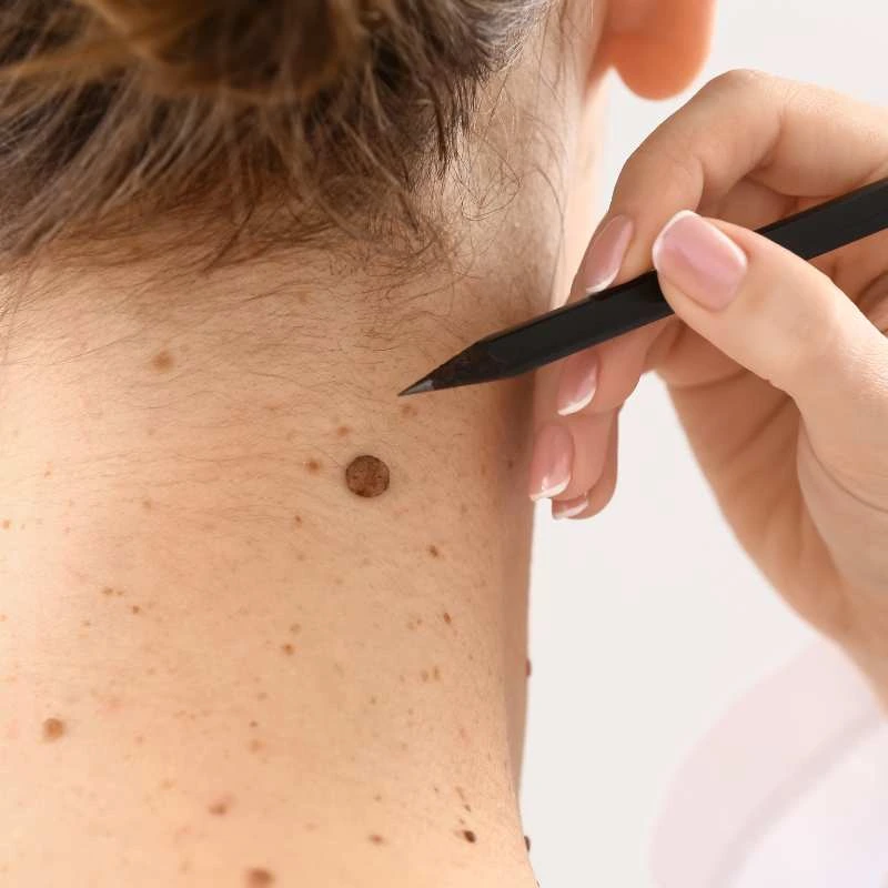 How to Support Your Body During Pregnancy for Faster Postnatal Recovery 5 See our lesion removal prices Ravensthorpe - call today for a free quote